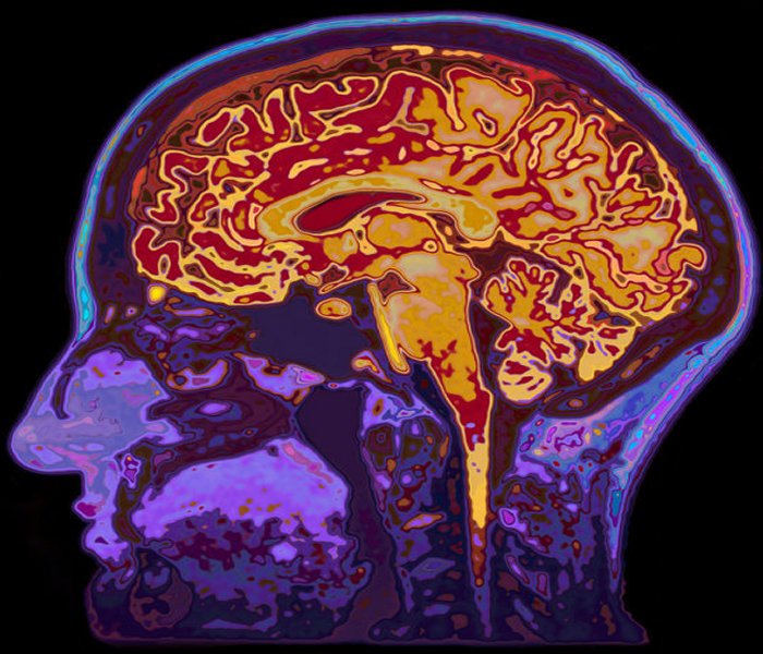 MRI image of brain (stock image). Postdoctoral researcher Patrick Watson studied the relationship between individual brain differences and cognitive abilities. Credit: © highwaystarz / Fotolia