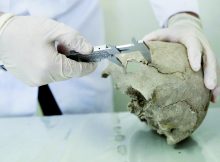 A skull found in one of the graves reveals a successful brain operation from the ancient ages. Photo: AA