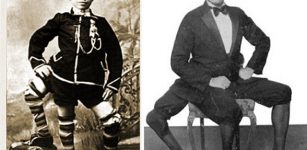 Francesco Lentini: The Three-Legged Wonder Man With Four Feet And 16 Toes Who Became A Celebrity