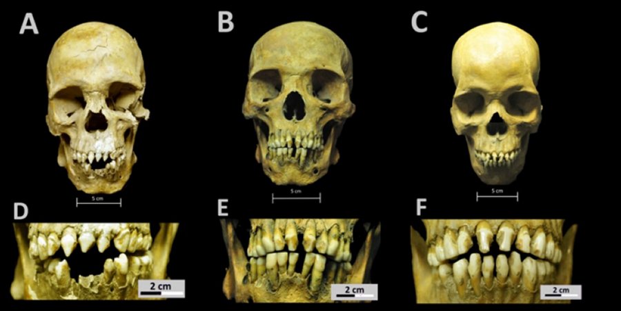 African Skeletons From Early Colonial Mexico And First-Generation Slaves