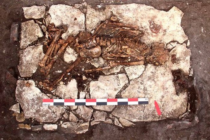 5,000-Year-Old Russian Skull Offers Evidence Of Brain Surgery Made With Stone Scalpel