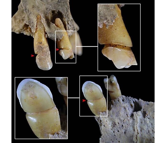 4,000 Years Ago Women Of El Argar Used Their Teeth As Tools