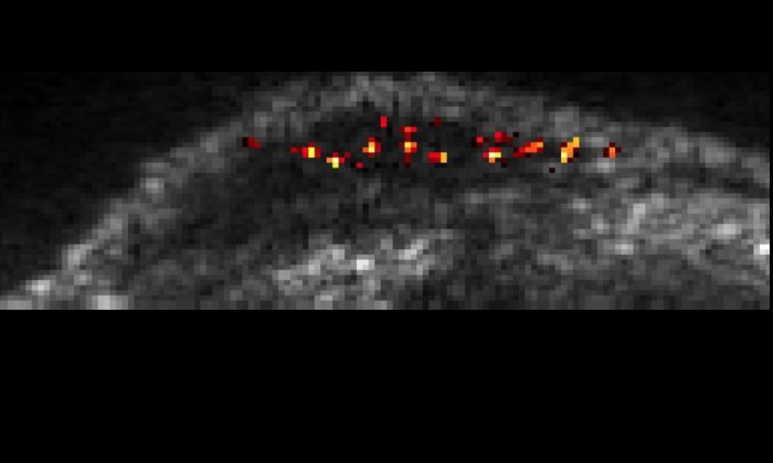 Single cells traveling through the liver of a mouse are highlighted by a new imaging technique developed in Mikhail Shapiro's lab. Credit: Caltech/Daniel Sawyer, Shapiro Lab