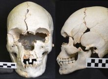 Rare Ancient Caribbean Skull Shows Evidence Of Leprosy