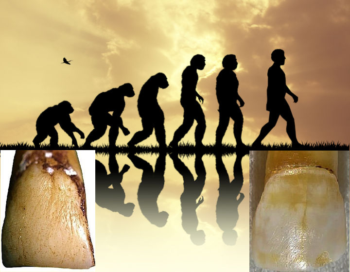 Strange Tooth Raises Unexpected Questions About Human Evolution