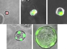 Human ES cell derived RASC (respiratory airway secretory cell) transitioning to an Alveolar type 2 cell over time in culture. Credit: University of Pennsylvania