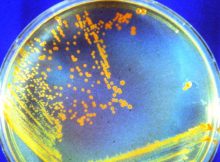 Deinococcus radiodurans (affectionately known as “Conan the Bacterium”) is particularly well-suited to surviving Mars' harsh environment. In experiments, it survived astronomical amounts of radiation in the freezing, arid environment. Credit: Michael J. Daly/USU