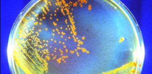 Deinococcus radiodurans (affectionately known as “Conan the Bacterium”) is particularly well-suited to surviving Mars' harsh environment. In experiments, it survived astronomical amounts of radiation in the freezing, arid environment. Credit: Michael J. Daly/USU