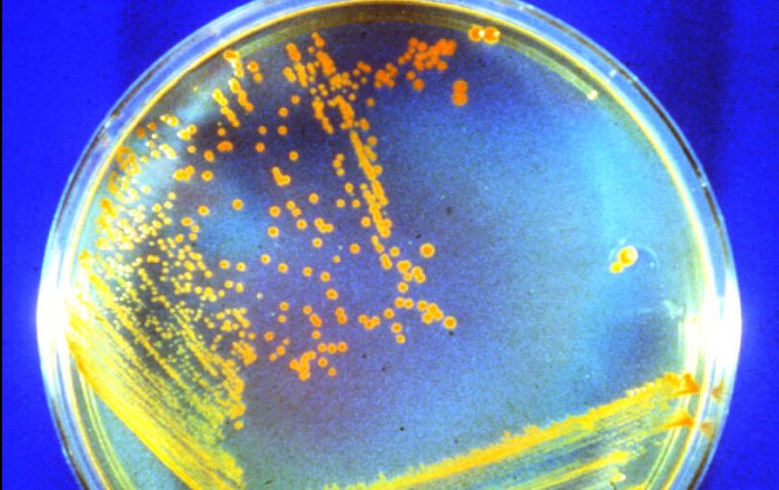 Deinococcus radiodurans (affectionately known as “Conan the Bacterium”) is particularly well-suited to surviving Mars' harsh environment. In experiments, it survived astronomical amounts of radiation in the freezing, arid environment. Credit: Michael J. Daly/USU