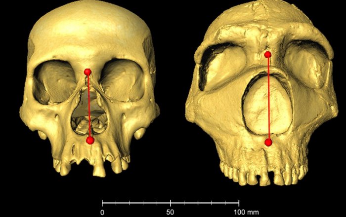 Nose Shape Gene Inherited From Neanderthals