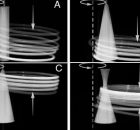 What Kinds Of Body Motions And Shapes Could Successfully Hold A Hula Hoop Up Against Gravity?